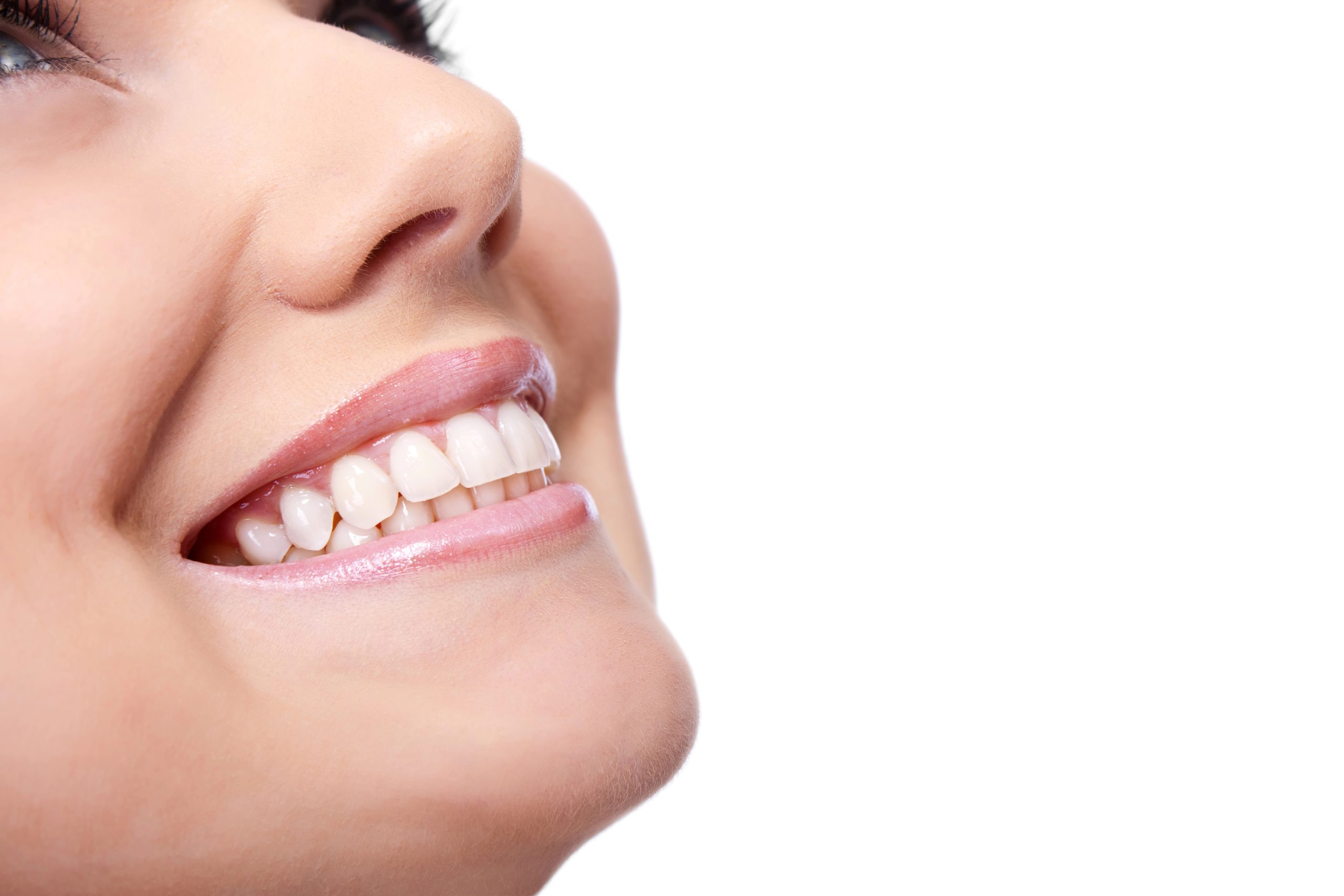 Best Teeth Whitening Tips in Snohomish